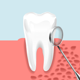 치아상태검진