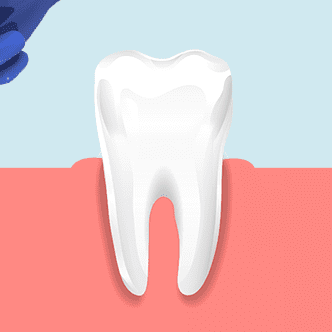 치아 주위 조직의 회복