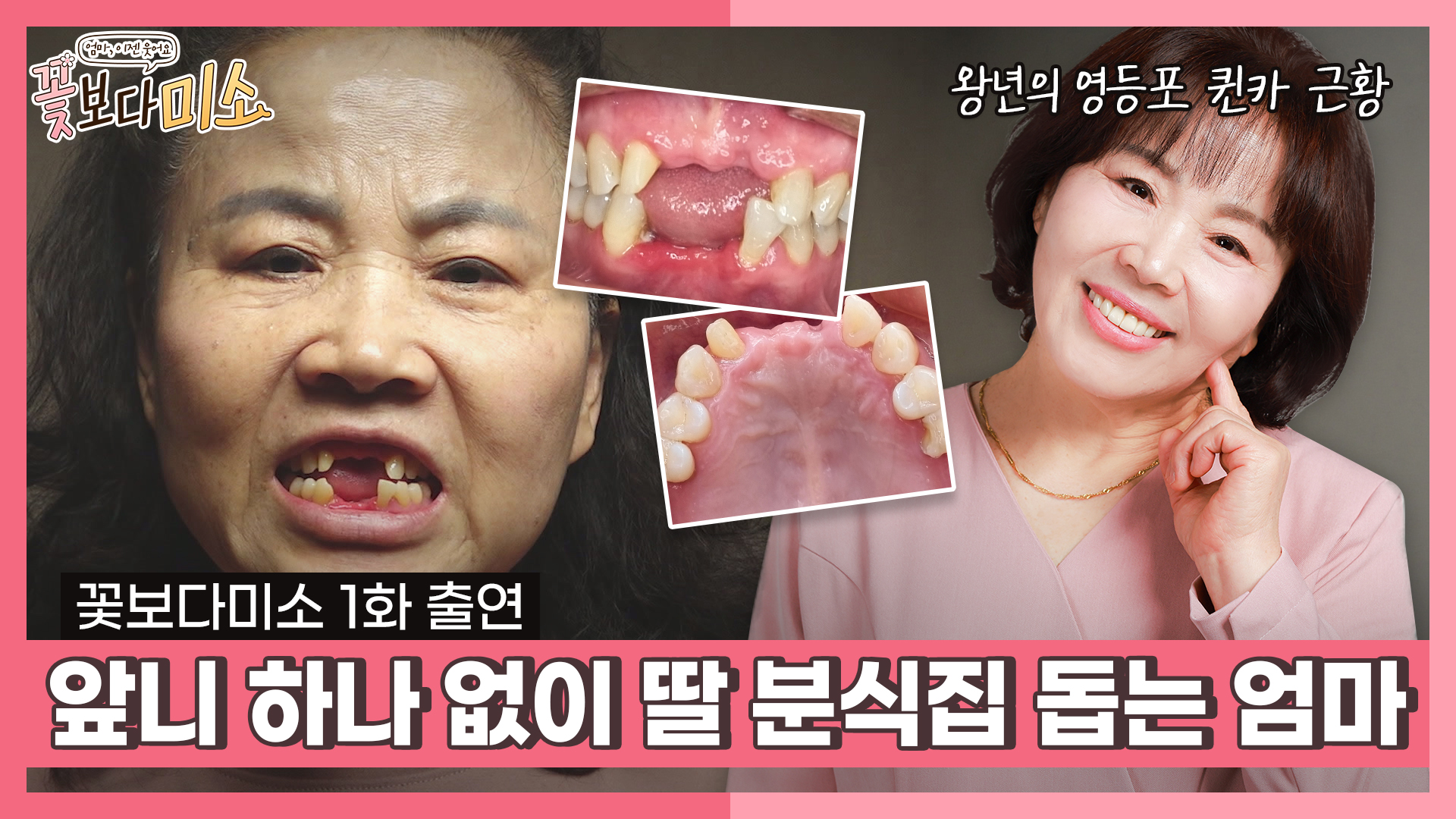공지사항 썸네일