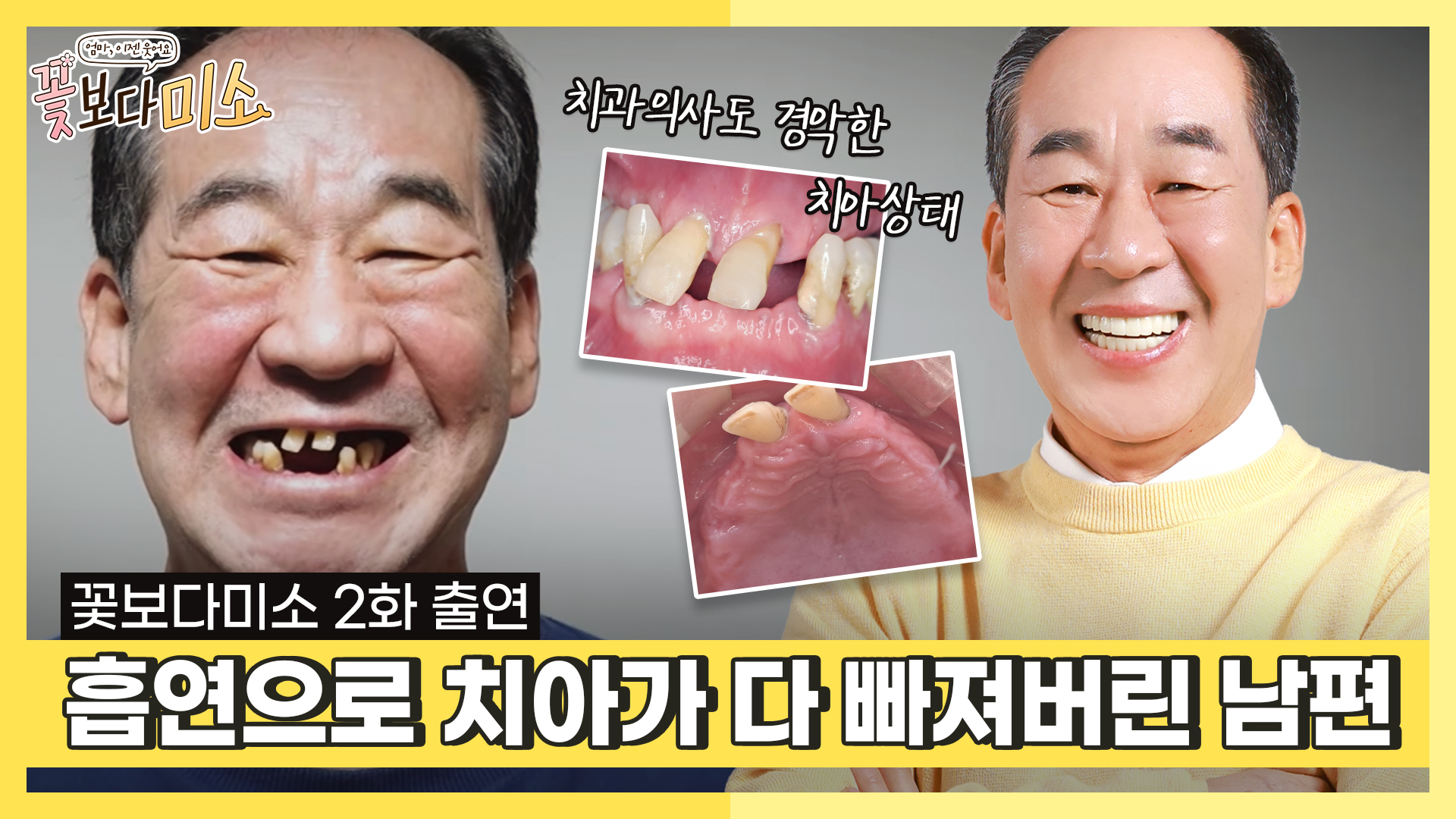 공지사항 썸네일